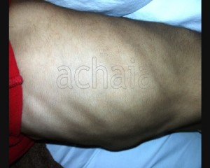 tetrapligiki-patra-2