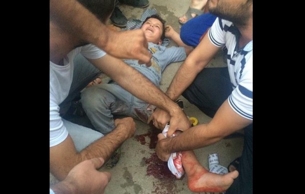 Τούρκοι ελεύθεροι σκοπευτές πυροβολούν τα παιδιά των Κούρδων (σκληρές φωτο)