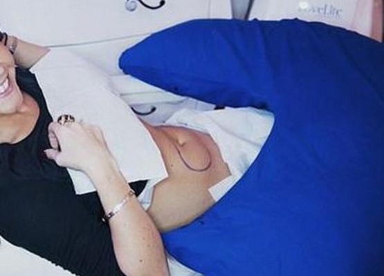 Έκανε λιποαναρρόφηση και μας δείχνει τα αποτελέσματα (εικόνες)