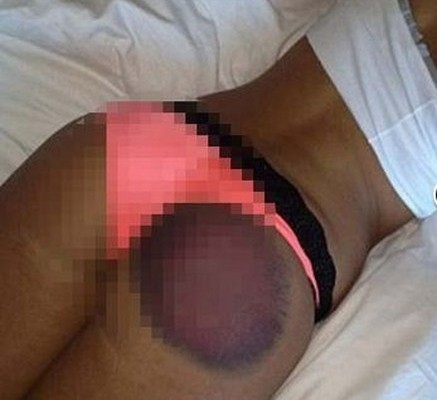 Παρουσιαστής χτύπησε μοντέλο στα οπίσθια και εκείνη του έκανε μήνυση (βίντεο)