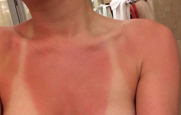 “Τσουρουφλίστηκε” πασίγνωστη τραγουδίστρια (εικόνες)