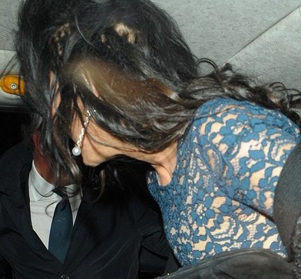 Απίστευτο! Άρχισε να χάνει τα μαλλιά της!