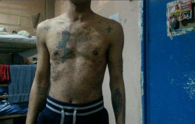 Συμπαράσταση στον αγώνα τον κρατουμένων στο Νοσοκομείο “Άγιος Παύλος”