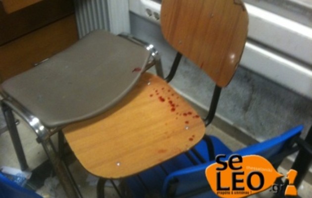 Στο νοσοκομείο δύο φοιτητές, δέχθηκαν επίθεση μέσα στο Πανεπιστήμιο Μακεδονία (εικόνες)