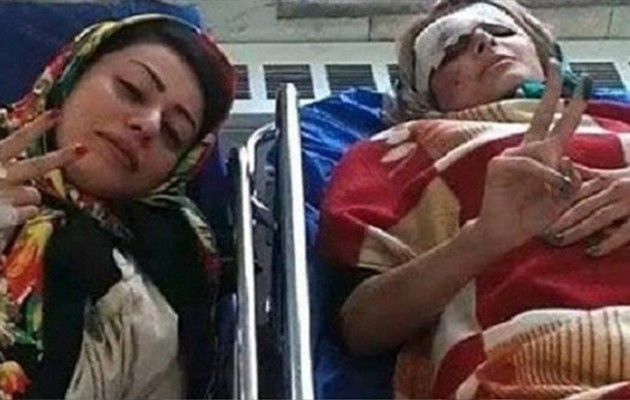 Τραβούσαν selfie και τράκαραν! Μια ξανθιά και η φίλη της