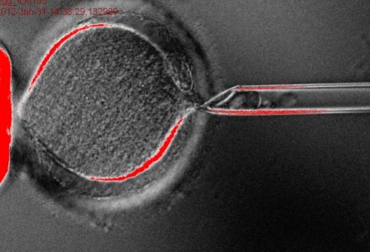 Έφτιαξαν σπερματοζωάρια από… δέρμα