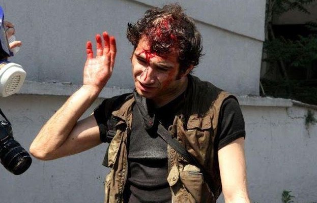 Κωνσταντινούπολη: Δεκάδες τραυματίες στις βίαιες οδομαχίες