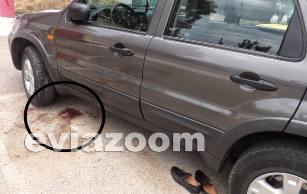 Χύθηκε αίμα σε στριπτιτζάδικο στη Χαλκίδα (εικόνες)