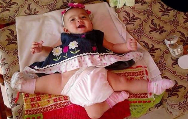 H Άννα γεννήθηκε με τρία πόδια και τώρα θα της αφαιρέσουν τα δύο (βίντεο)