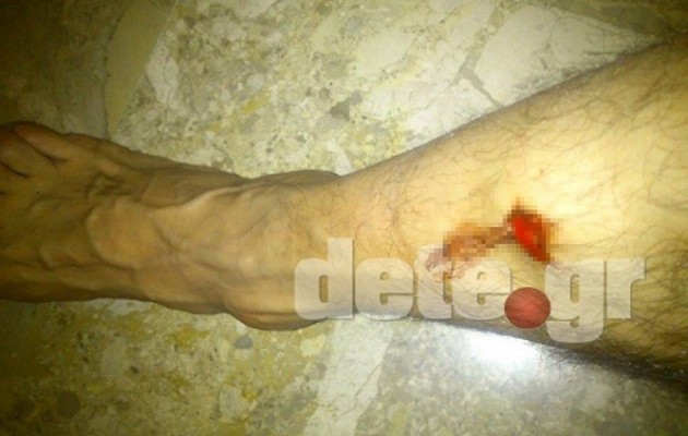 Πήγε σε γάμο κι έφυγε με σφαίρα στο πόδι