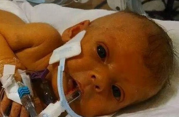 Η απίστευτη ιστορία του πατέρα που ζητά να δει την νεκρή κόρη του χωρίς σωληνάκια