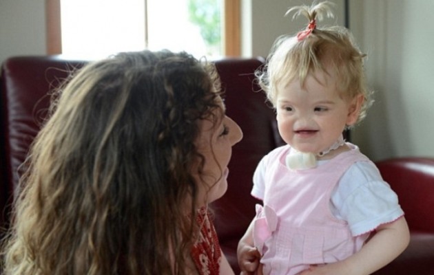 Η μικρή Τέσα είναι ένα αξιολάτρευτο μωρό που γεννήθηκε χωρίς μύτη (εικόνες)