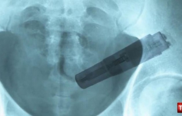 Ιατροδικαστής: Πέθανε από τον δονητή