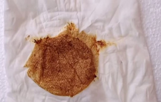 Δείτε τι προκαλεί το κάπνισμα (βίντεο)