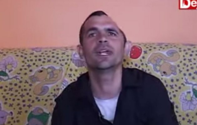 Είχε χάσει το μισό κεφάλι του σε ατύχημα – Τώρα είναι εντάξει (βίντεο)