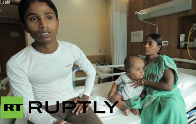 Ινδία: Καλά τα νέα για την μικρή Ρούνα με την ακραία υδροκεφαλία (βίντεο)