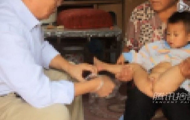 Εγκατέλειψαν το παιδί τους γιατί ήταν ερμαφρόδιτο (βίντεο)