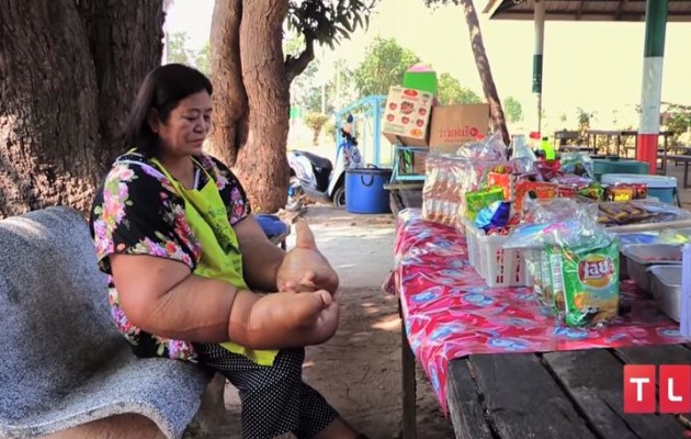 Ταϊλάνδη: Κάθε χέρι της ζυγίζει 10 κιλά (βίντεο)