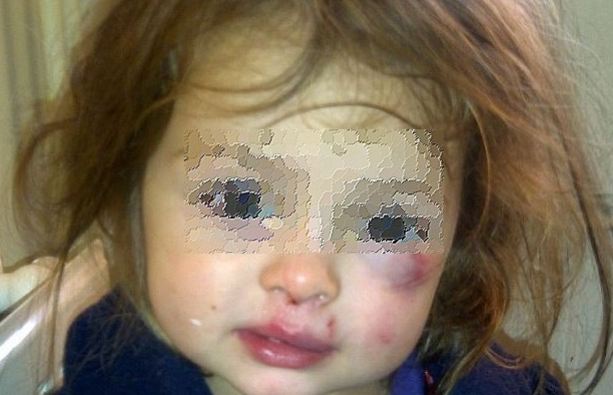 Ελεύθεροι οι γονείς – βασανιστές από την Πάτρα