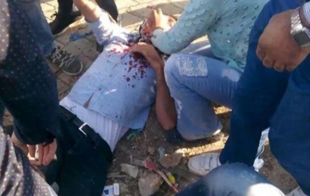 Ο τουρκικός στρατός άνοιξε πυρ πάνω σε διαδηλωτές – Χύθηκε αίμα!