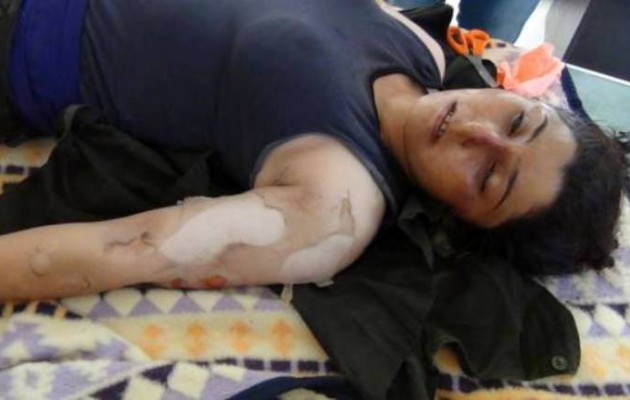 Κομπάνι: Το Ισλαμικό Κράτος ρίχνει χημικά αέρια στους Κούρδους