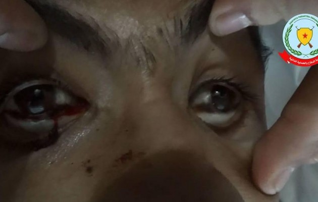 Κομπάνι: Οι τζιχαντιστές χρησιμοποίησαν χημικά όπλα