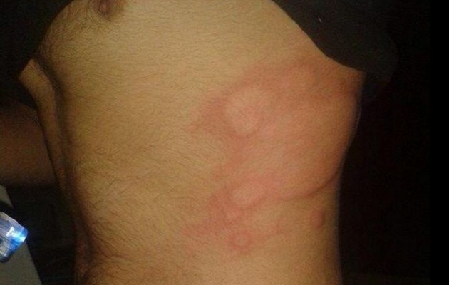 Κομπάνι: Νέες φωτογραφίες από τα χημικά των τζιχαντιστών