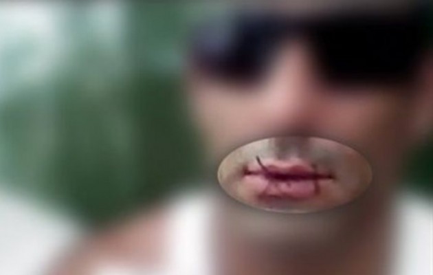 Ράβουν το στόμα τους για να μην απελαθούν