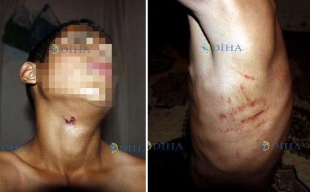 Οι Τούρκοι αστυνομικοί βασάνισαν 13χρονο Κούρδο