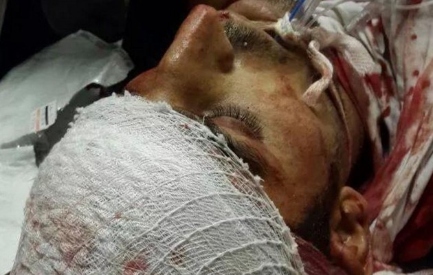 Νεκρός Κούρδος διαδηλωτής – Του είχαν επιτεθεί με χαντζάρες και όπλα (φωτο)
