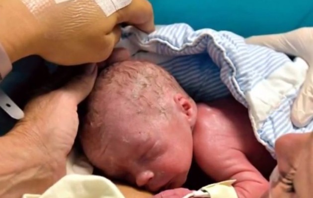 Δείτε το πρώτο παιδί που γεννήθηκε μετά από μεταμόσχευση μήτρας (βίντεο)