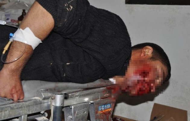 Οι Τούρκοι πυροβόλησαν Κούρδο πρόσφυγα από την Κομπάνι