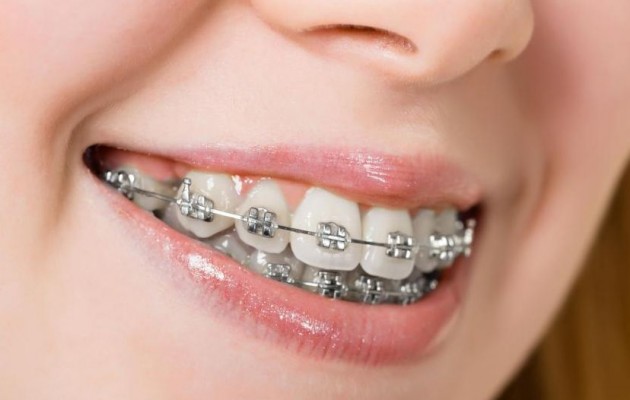 Εκπληκτικό βίντεο: Δείτε πως λειτουργούν τα σιδεράκια