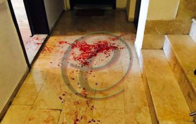 Οι πρώτες φωτογραφίες του Κούρδου πολιτικού μετά την επίθεση