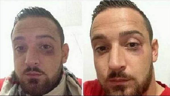 Φεύγει από την Τουρκία ο ποδοσφαιριστής που ξυλοκοπήθηκε από τζιχαντιστές
