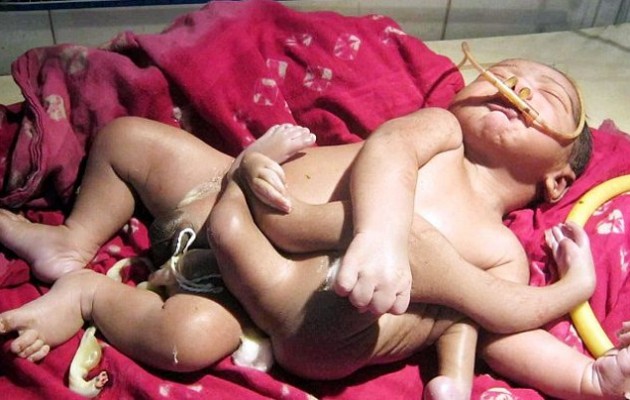 Μωρο… χταπόδι στην Ινδία λατρεύεται ως θεός