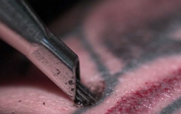 Δείτε πώς βγαίνει το τατουάζ με λέιζερ (βίντεο)
