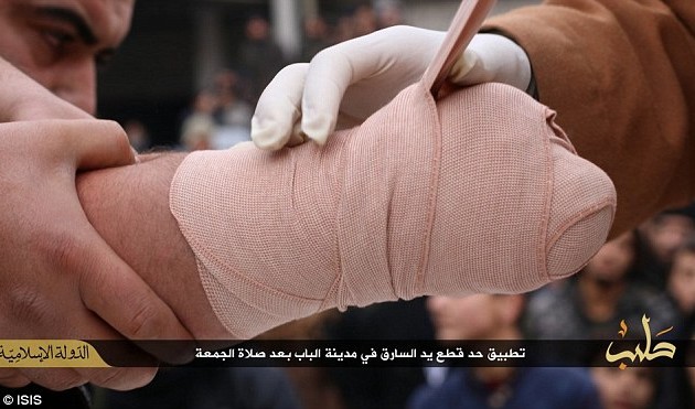 Το Ισλαμικό Κράτος έκοψε το χέρι άνδρα που καταδικάστηκε για κλοπή
