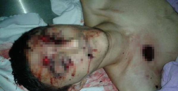 Τούρκοι αστυνομικοί σκότωσαν 17χρονο Κούρδο (φωτο + βίντεο)