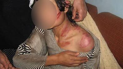 Τοπικός αιρετός σάπισε στο ξύλο 27χρονη εργαζόμενη καφενείου στον Ερύμανθο