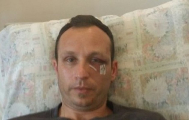 Ανακοίνωση της οικογένειας του γιατρού που ξυλοκοπήθηκε από ακροδεξιούς