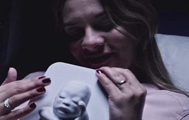 Τυφλή μητέρα «είδε» το αγέννητο μωρό της με τα χέρια της (φωτογραφίες και βίντεο)