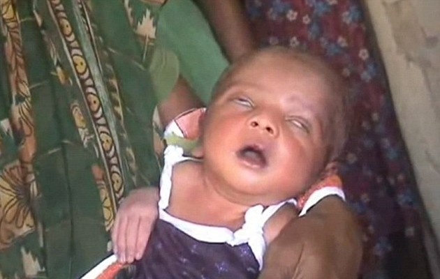 «Μάγισσα» βασανίζει άρρωστο μωρό στην Ινδία (φωτογραφίες και βίντεο)