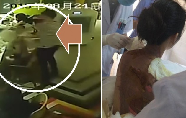 Πρωτοφανές! Σερβιτόρος «έλουσε» με ζεματιστή σούπα πελάτισσα – 42% εγκαύματα! (βίντεο)