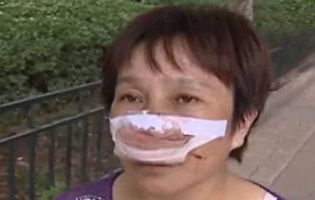 Φρίκη: Της έκοψε τη μύτη με τα δόντια και την κατάπιε!