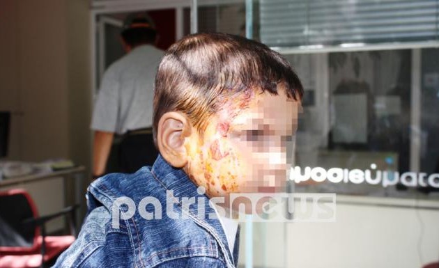 Εργοδότης έριξε ζεματιστό καφέ σε 2χρονο αγόρι για 120 ευρώ!