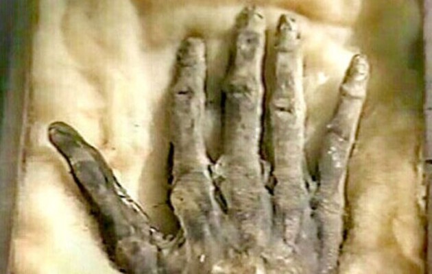 Βρέθηκε ένα Χέρι της Δόξας – Ποιες είναι οι μαγικές δυνάμεις που το περιβάλλουν!