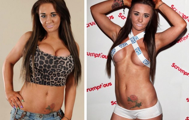 Ιερόδουλη έκανε έκτρωση για να κάνει πλαστική στη μύτη (φωτογραφίες)