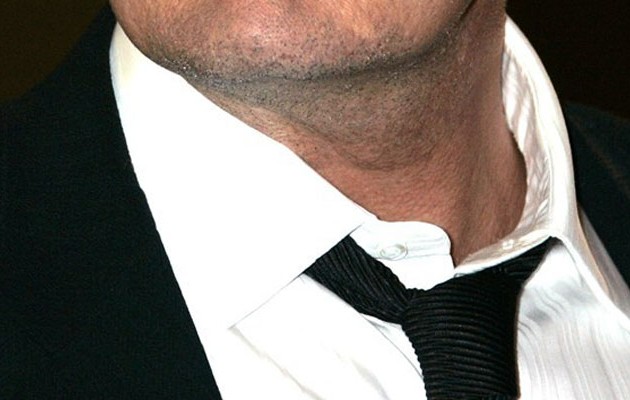 Ποιος πασίγνωστος ηθοποιός δίνει μάχη με το AIDS (φωτο)