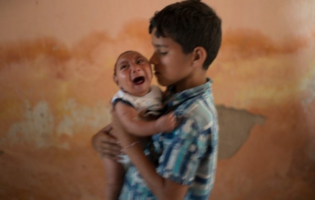 Συναγερμός! Γεννιούνται παιδιά με μικρά κεφάλια στη Λατινική Αμερική